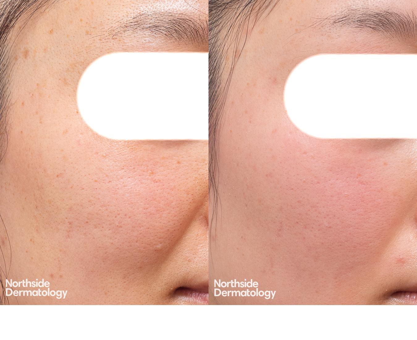 Revitalizing Options for Dull ⁤and ‌Tired Skin